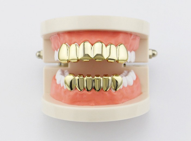 gigi emas palsu
