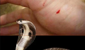 gigitan ular kobra