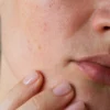 Cara menghaluskan kulit wajah yang kasar