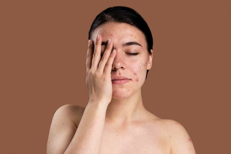 6 Efek samping minyak zaitun untuk wajah.
