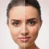 Tips pakai kosmetik terbaik untuk wajah sensitif.