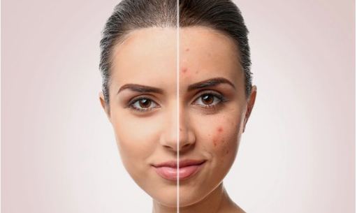 Tips pakai kosmetik terbaik untuk wajah sensitif.