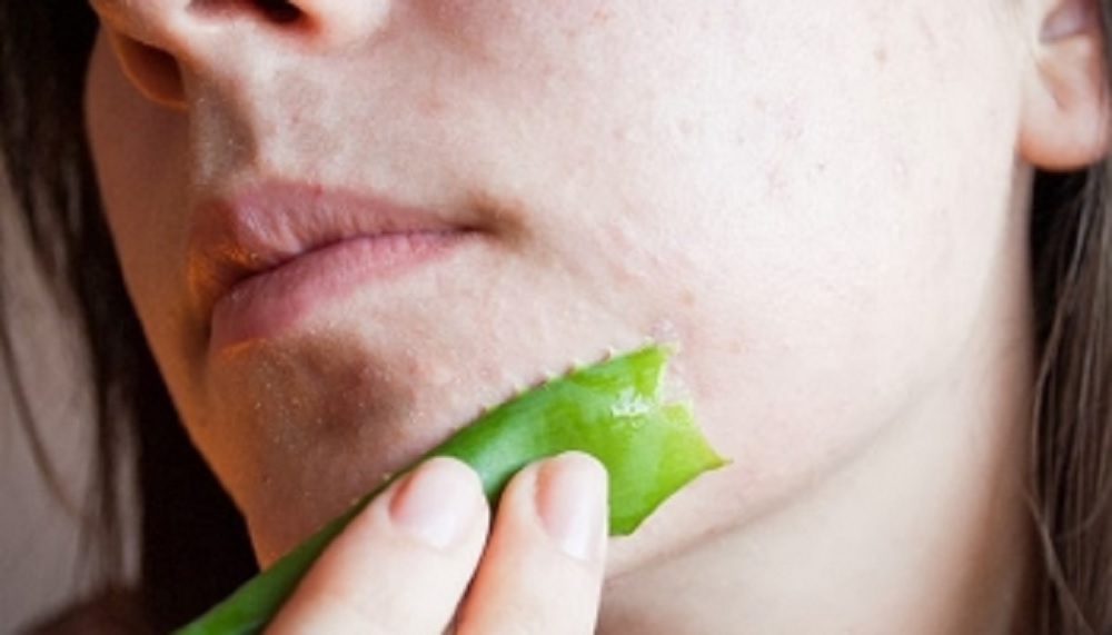 Apakah lidah buaya bisa mencerahkan atau memutihkan kulit