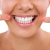 Gigi Putih Bersih Tanpa Karang Gigi
