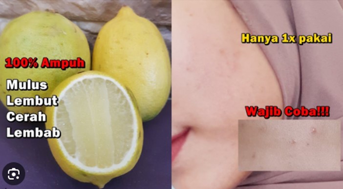 masker lemon untuk kulit sensitif