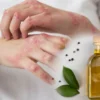 efek samping minyak zaitun pada kulit