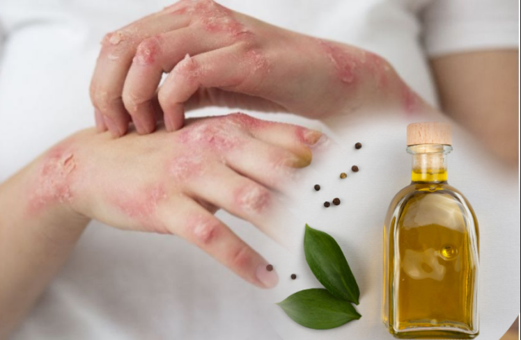 efek samping minyak zaitun pada kulit