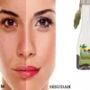 Apakah minyak zaitun bisa menghilangkan keriput di wajah?