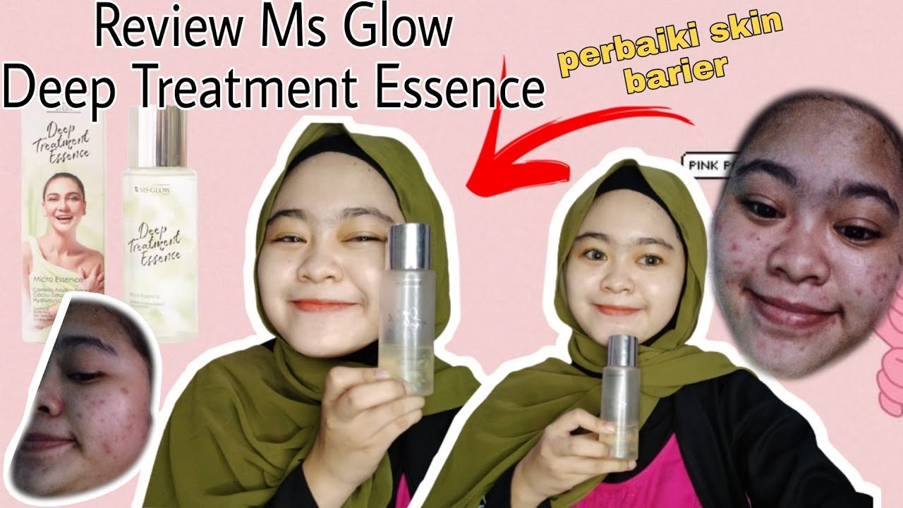 Manfaat Deep Treatment Essence Ms Glow