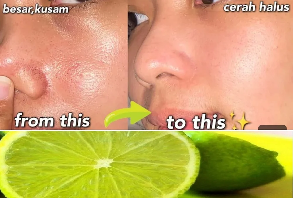 jeruk nipis untuk wajah berkomedo