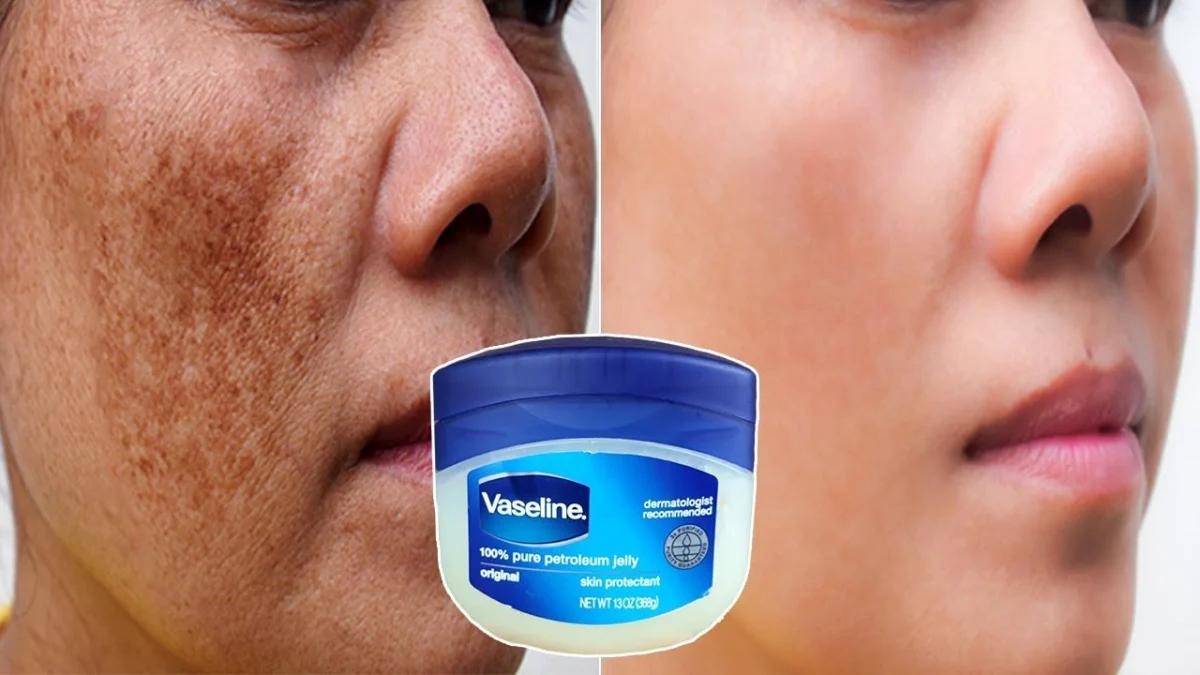 Vaseline agar kulit wajah putih.