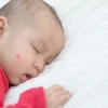 menghilangkan bentol di kulit bayi secara alami